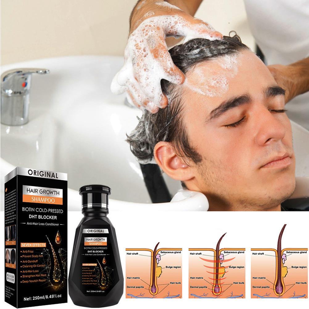 250ML Biotin Ginger Shampoo Co - Biotin Shampoo Thickening recensione e prezzo
