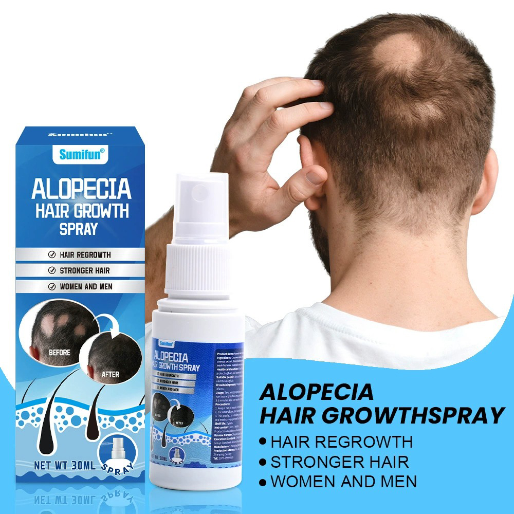 Alopecia Hair Growth Spray Sop - Hair Care Growth recensione e prezzo