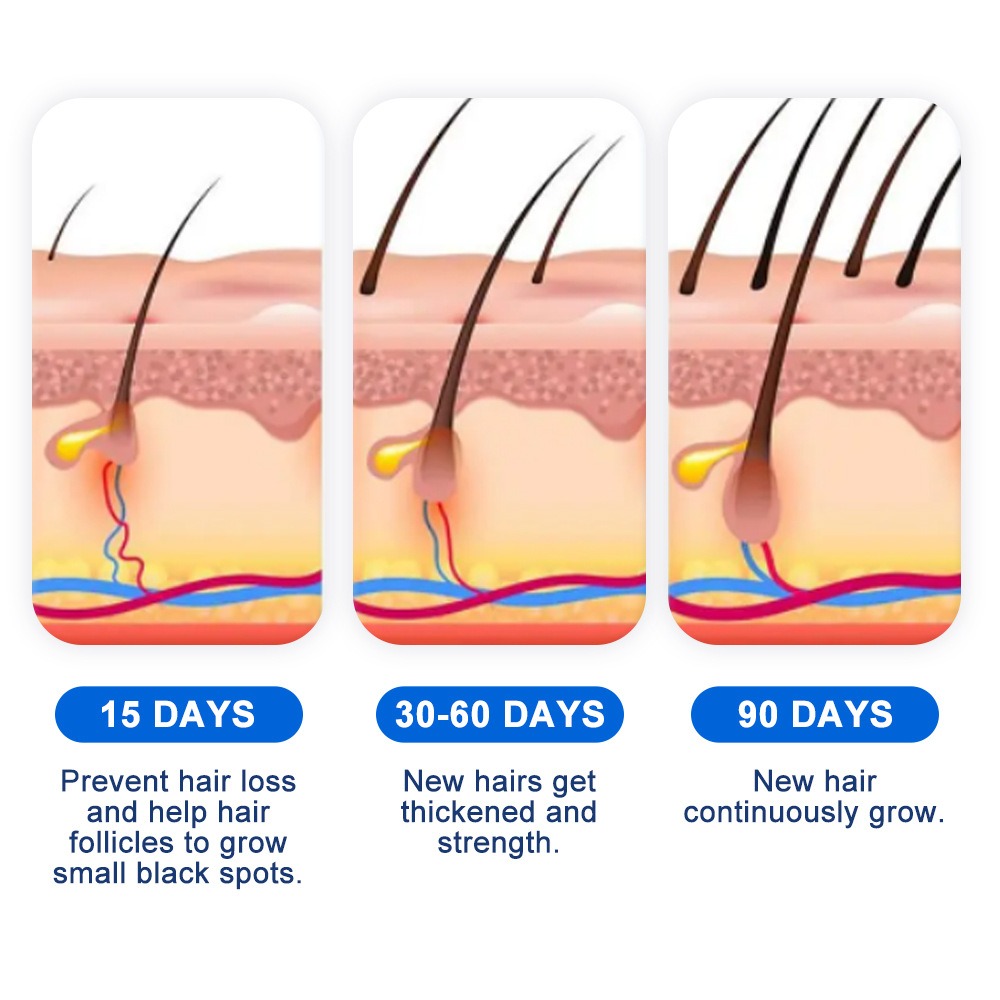 Alopecia Hair Growth Spray Sop - Hair Care Growth recensione e prezzo