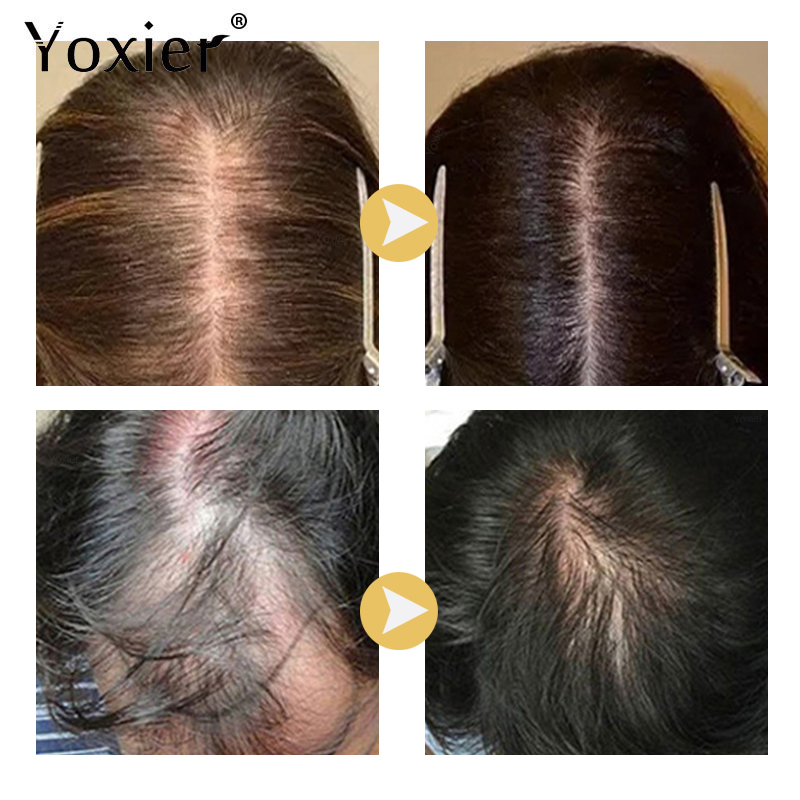 Intensive Growth Serum Prevent - Hair Care Growth recensione e prezzo