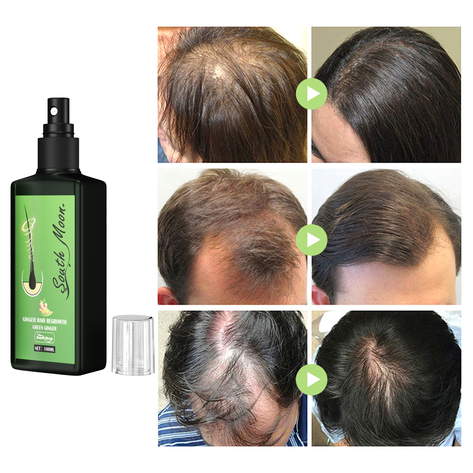 Ginger Hair Density Serum Spra - Hair Care For Hair Fall recensione e prezzo