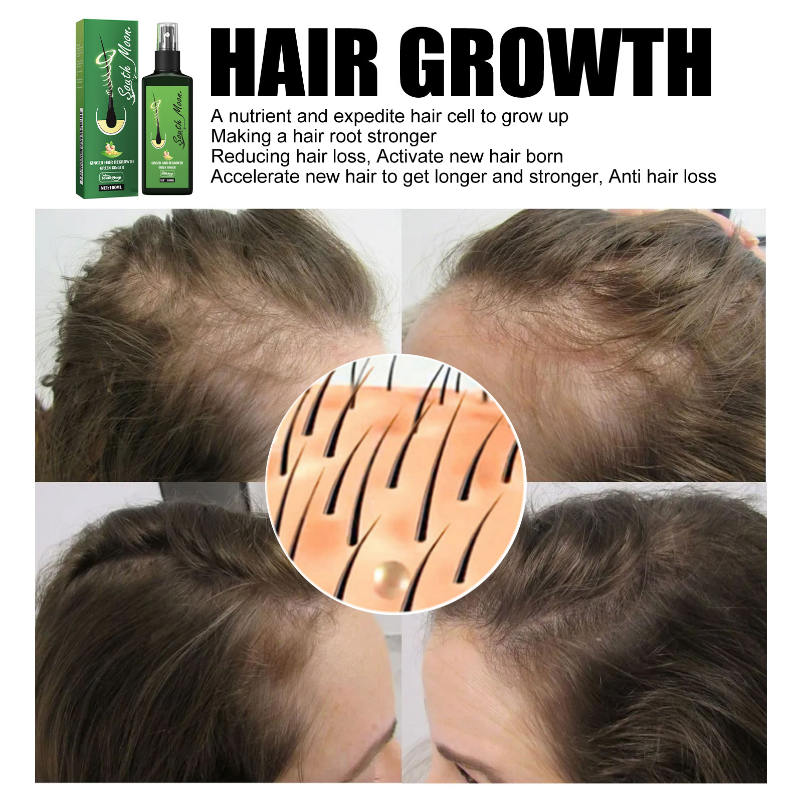 Ginger Hair Density Serum Spra - Hair Care For Hair Fall recensione e prezzo