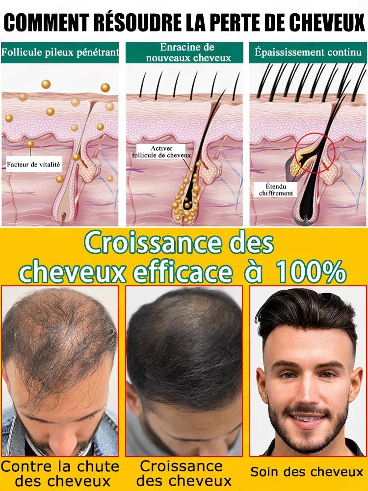Anti Hair Loss Growth Serum, R - Hair Care For Hair Fall recensione e prezzo