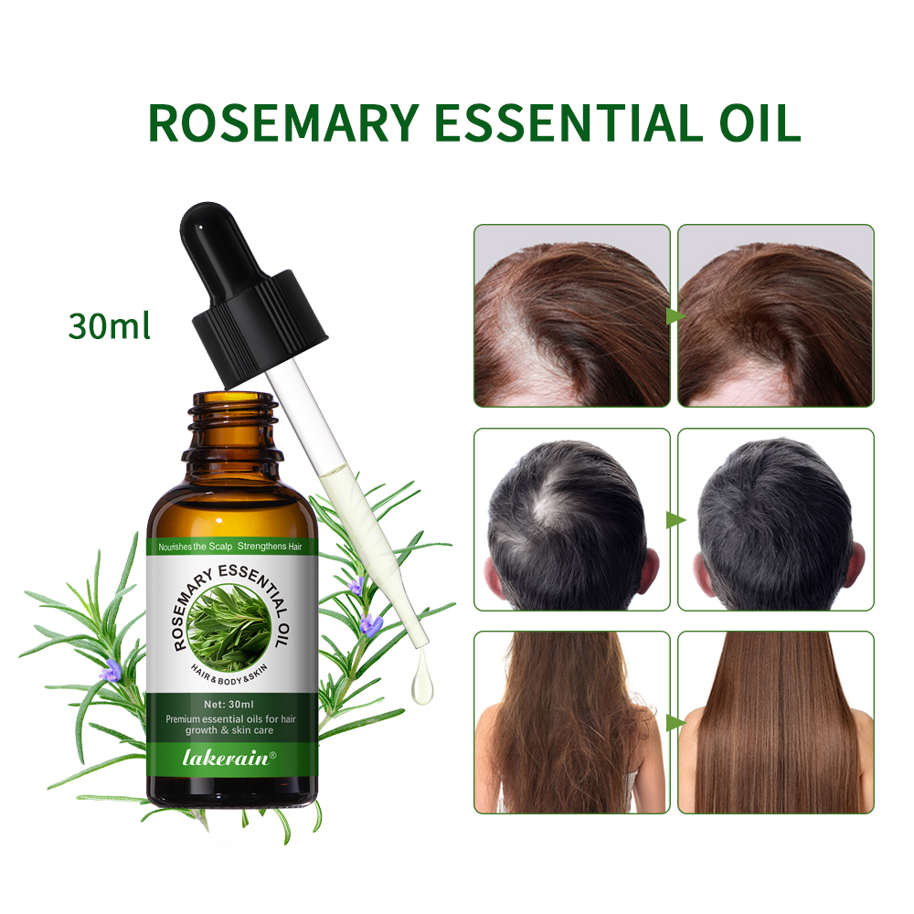 30ML Rosemary Hair Care Oil An - Hair Care For Hair Fall recensione e prezzo