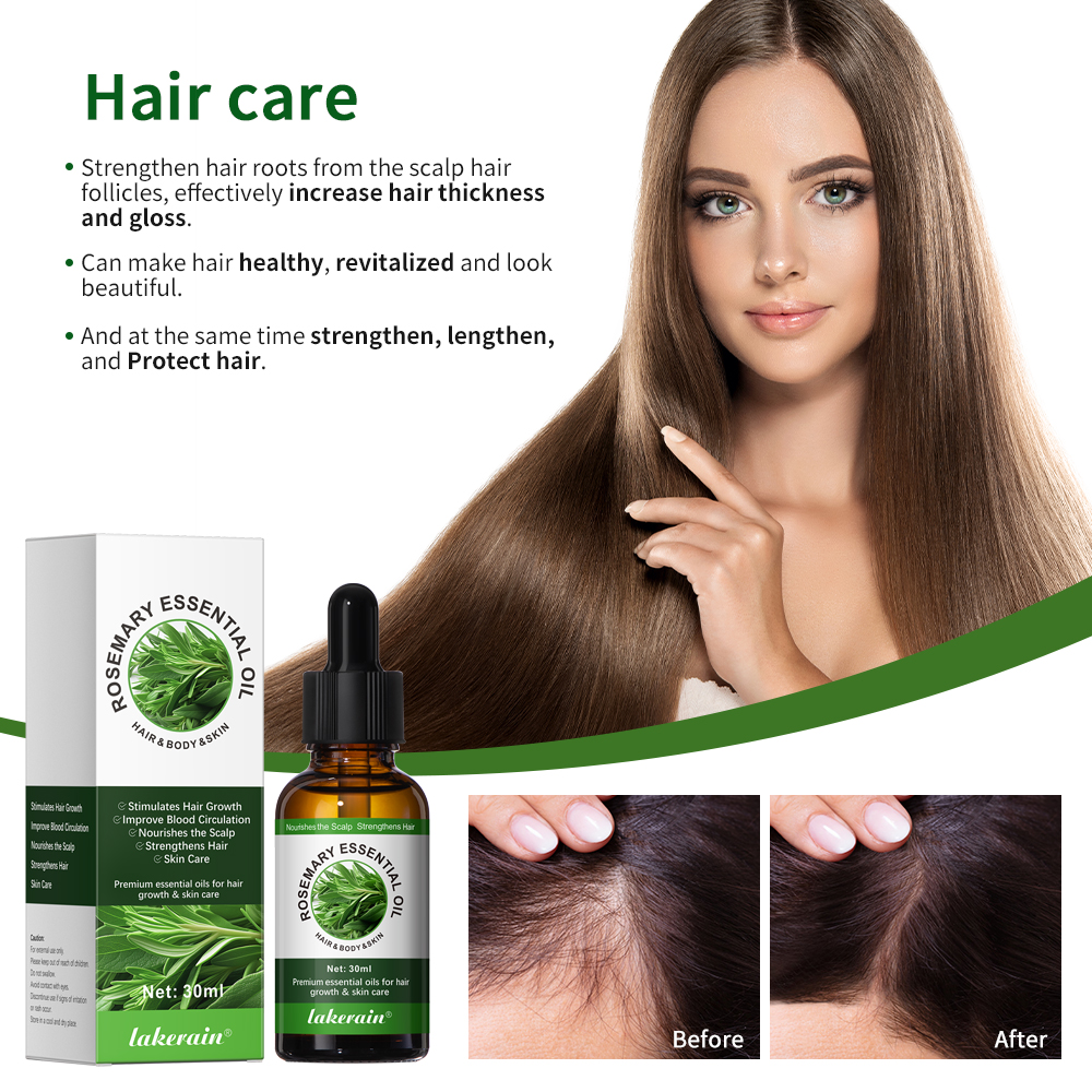 30ML Rosemary Hair Care Oil An - Hair Care For Hair Fall recensione e prezzo
