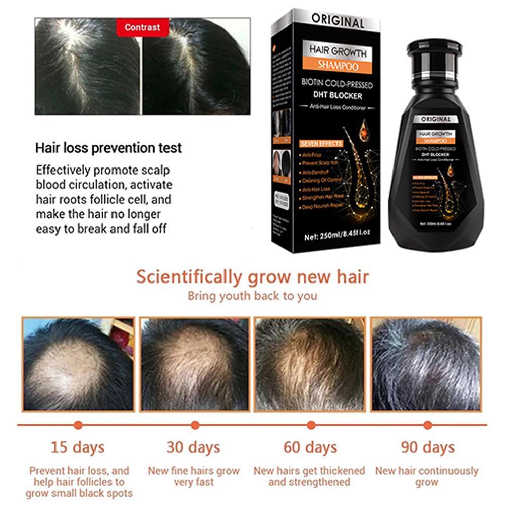 Biotin Ginger shampoo Thickeni - Biotin Shampoo Thickening recensione e prezzo