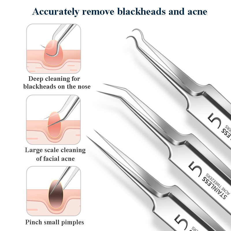 4-11Pcs Ingrown Hair Tweezers  - Hair Care Clinic recensione e prezzo