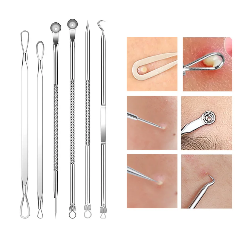 4-11Pcs Ingrown Hair Tweezers  - Hair Care Clinic recensione e prezzo