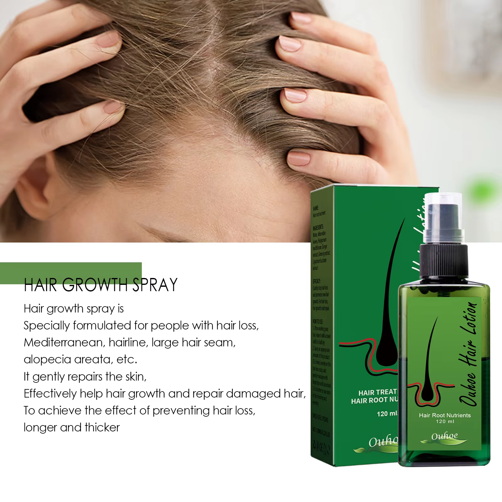 Hair Growth Spray Anti Hair Lo - Hair Care For Hair Loss recensione e prezzo