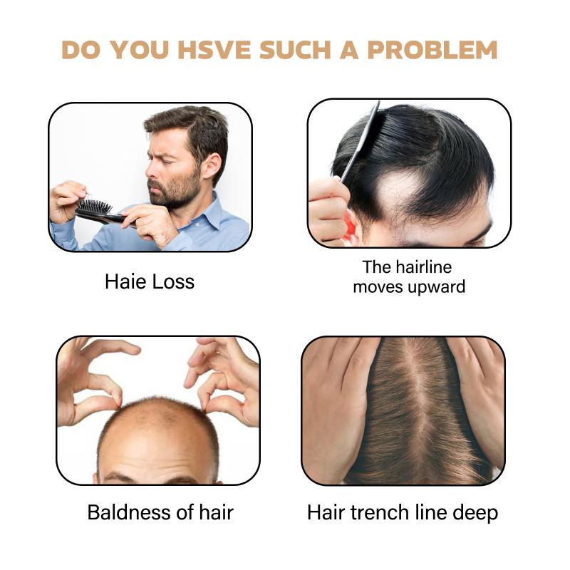 East Moon Hair Thickening Sham - Hair Care For Hair Fall recensione e prezzo
