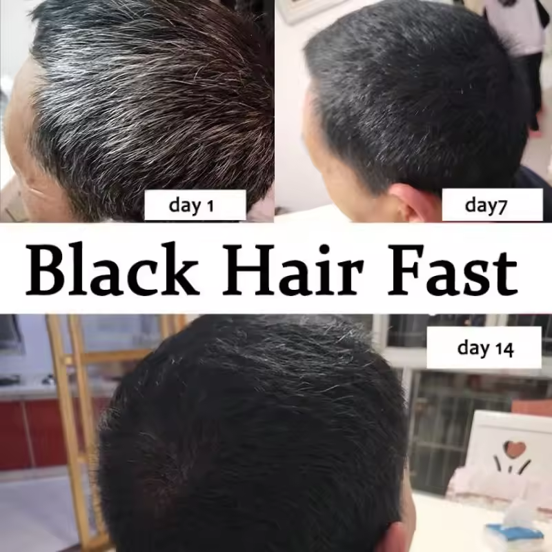 Gray White Hair Treatment Seru - Hair Care Korea recensione e prezzo