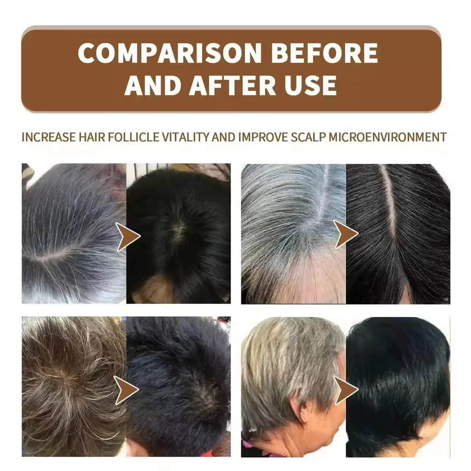 Gray White Hair Treatment Seru - Hair Care Korea recensione e prezzo