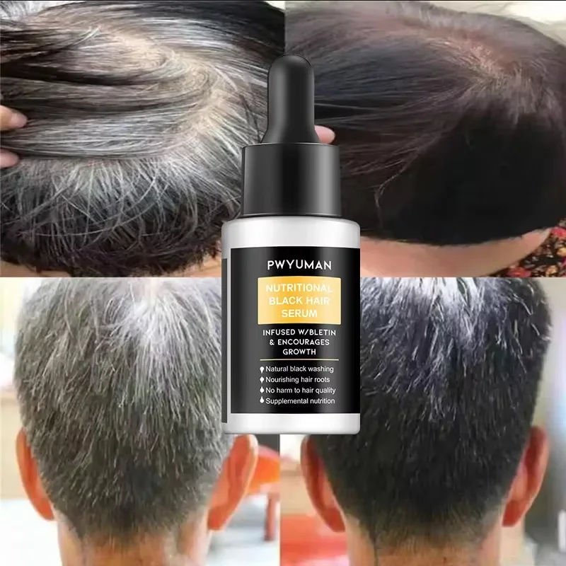 Gray White Hair Treatment Seru - Hair Care Korea recensione e prezzo