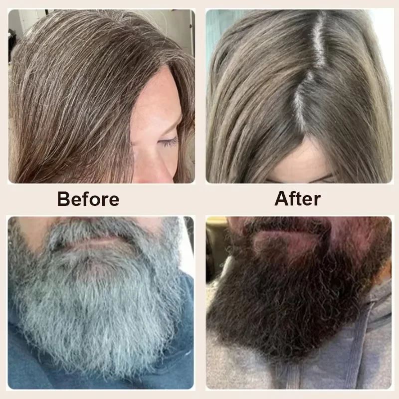 Gray White Hair Treatment Seru - Hair Care Korea recensione e prezzo