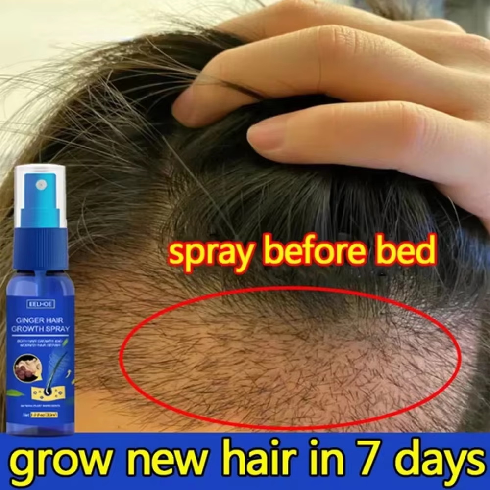 Ginger Hair Growth spray Anti  - Hair Care For Hair Loss recensione e prezzo