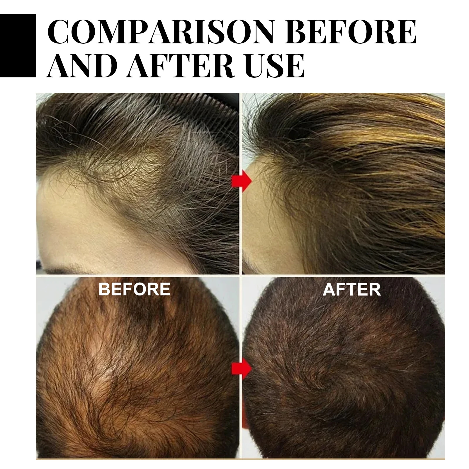 Ginger Hair Growth spray Anti  - Hair Care For Hair Loss recensione e prezzo