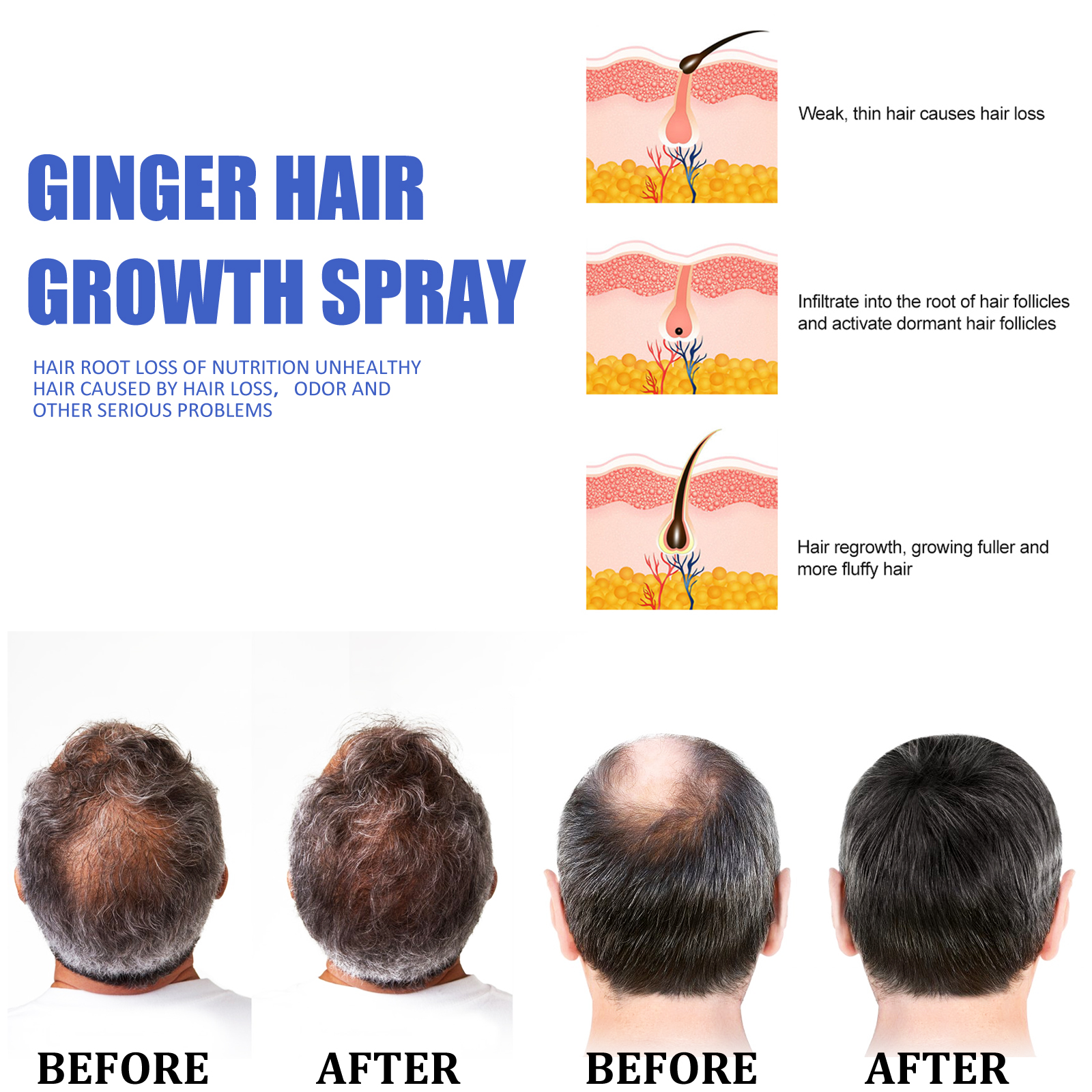 Ginger Hair Growth spray Anti  - Hair Care For Hair Loss recensione e prezzo