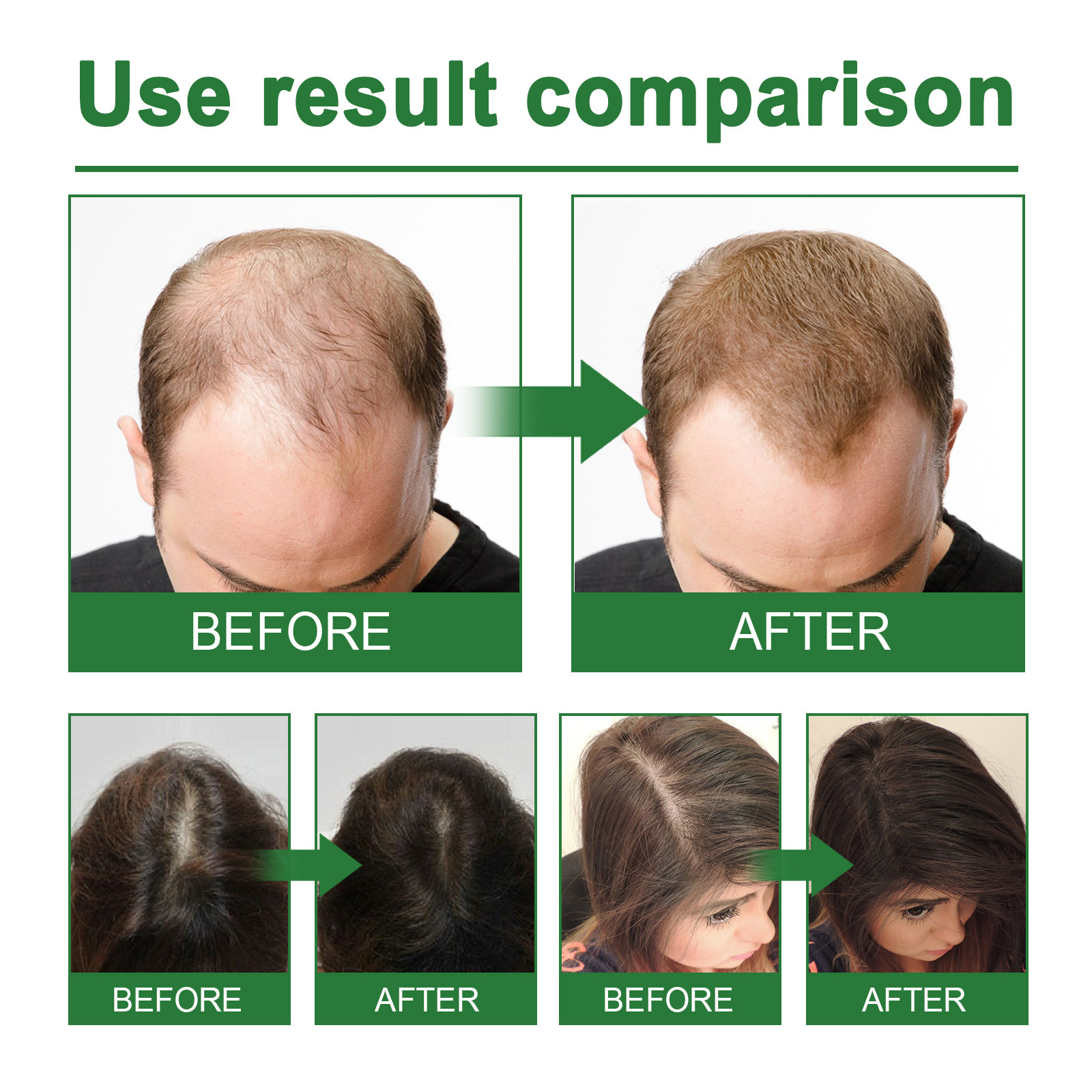 Rosemary Spray for Hair Nouris - Hair Care Growth recensione e prezzo