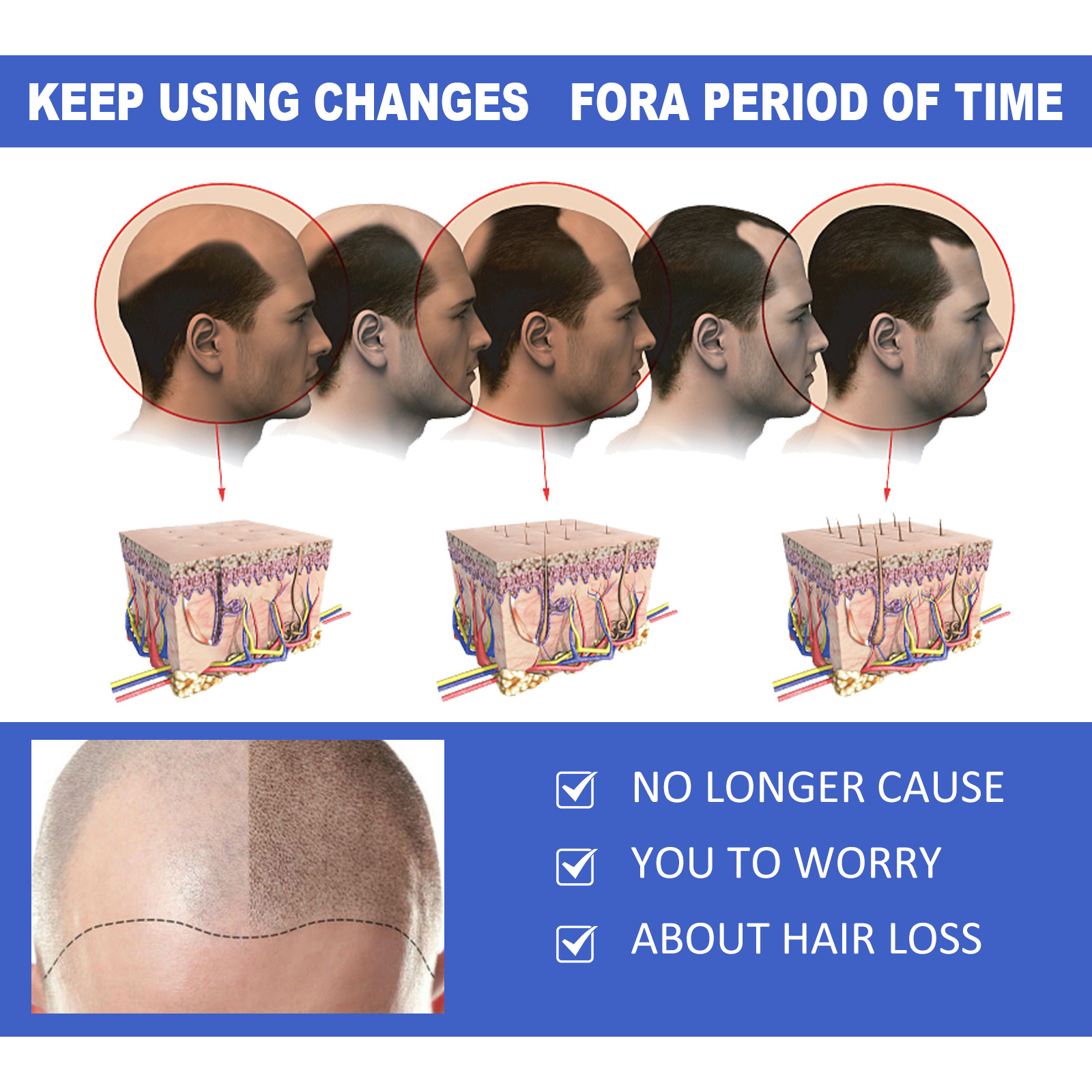 EELHOE Ginger Hair Care Serum  - Hair Care For Hair Fall recensione e prezzo