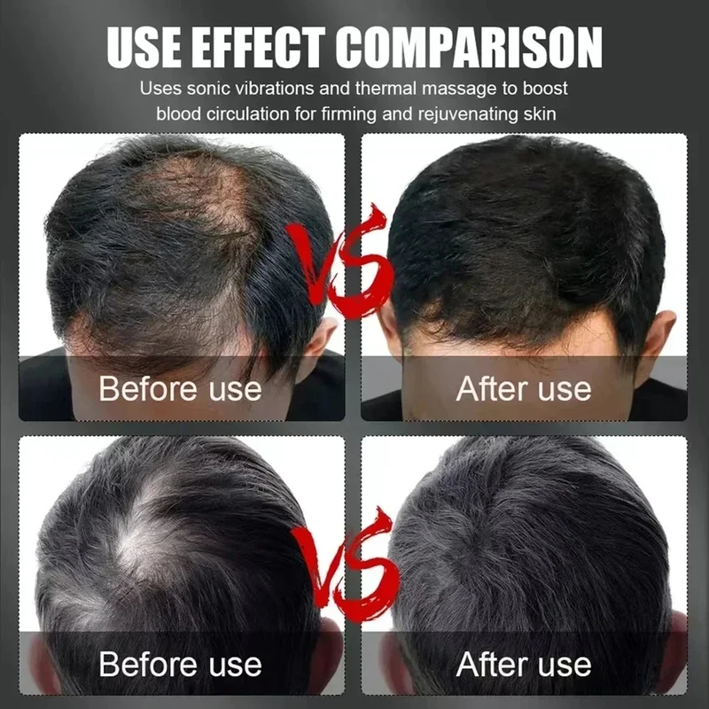 660nm 850nm Red Light Infrared - Hair Care Growth recensione e prezzo